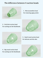 Blackhead and Acne Vacuum