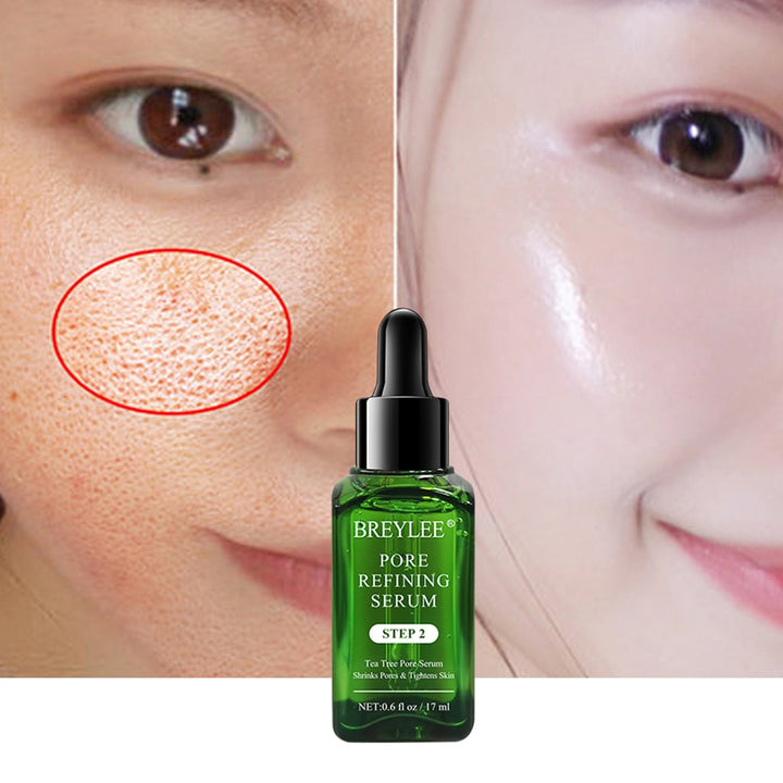 Acne Treatment Mask