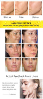 Vitamin C Facial Mask
