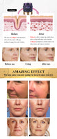 Vitamin C Facial Mask