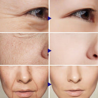 Anti-Aging Mask