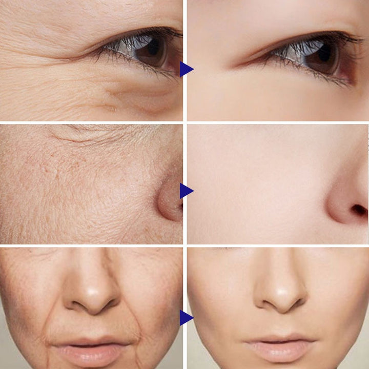 Anti-Aging Mask