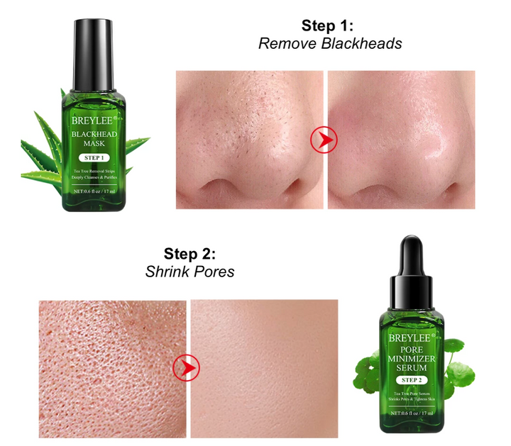 Blackhead Remover Serum & Sheets